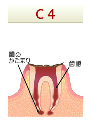 C4