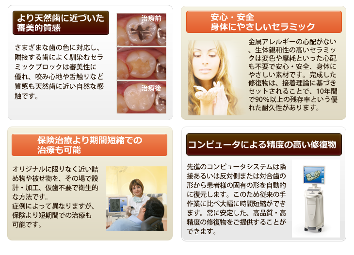 セレックシステムのアピールポイント
